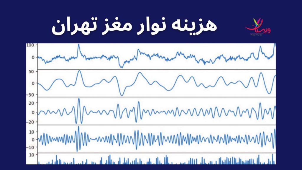 کلینیک ویستان مراحل انجام نوار مغز