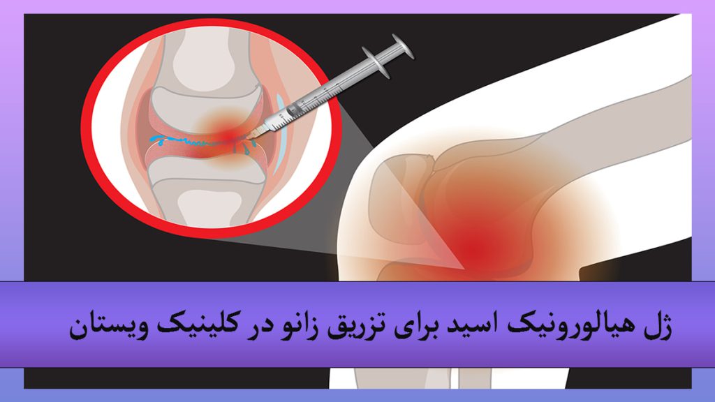 تصویر دیجیتالی از یک زانو و تزریق ژل به زانو