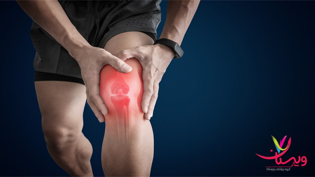 درد آرتروز زانو آقایی به دلیل بیماری آرتروز دچار درد زانو شده است