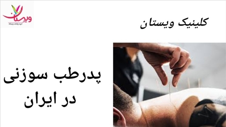 دکتر ایزدی عضو اصلی انجمن علمی طب سوزنی ایران و چین است و دارای مجوز رسمی از وزارت بهداشت و درمان ایران می باشد. پدر طب سوزنی درایران