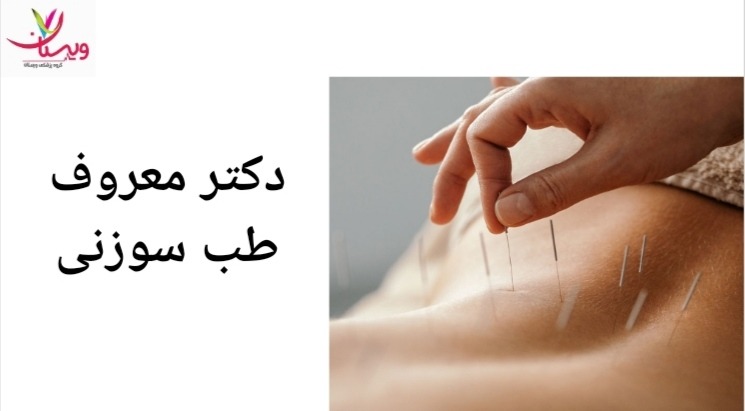 دکتر شبنم رفیع زاده از معروف ترین پزشکان طب سوزنی می باشد. دکتر معروف طب سوزنی