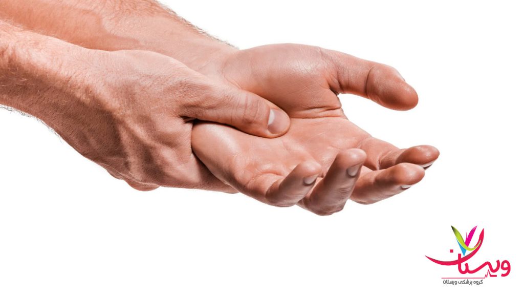 آرتروز در دست های یک بیمار فردی که به دلیل آرتروز دچار درد دست ها شده است