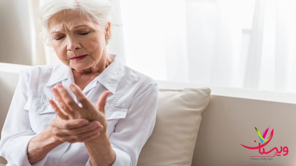 آرتروز در بیمار خانمی که به آرتروز مبتلا شده است