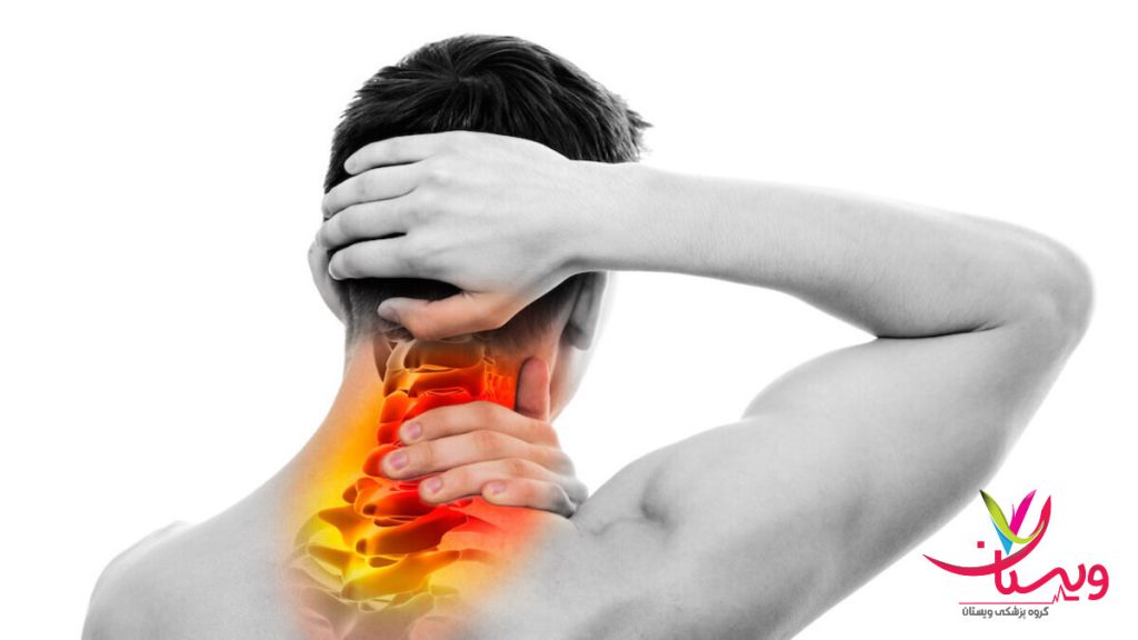 آرتروز گردن در بیمار آقایی که دچار آرتروز گردن شده است