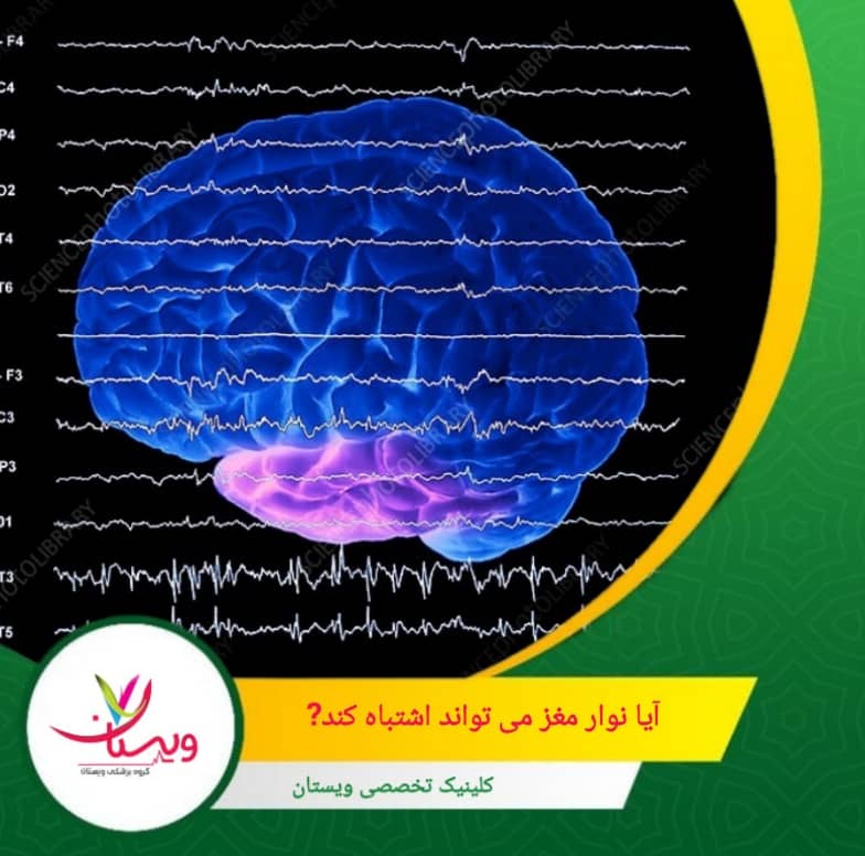 کیفیت دستگاه و روش انجام آزمایش بسیار مهم است: تجهیزات قدیمی یا روشهای غیرحرفهای احتمال خطا را افزایش میدهند. آیا نوارمغز میتواند اشتباه کند؟