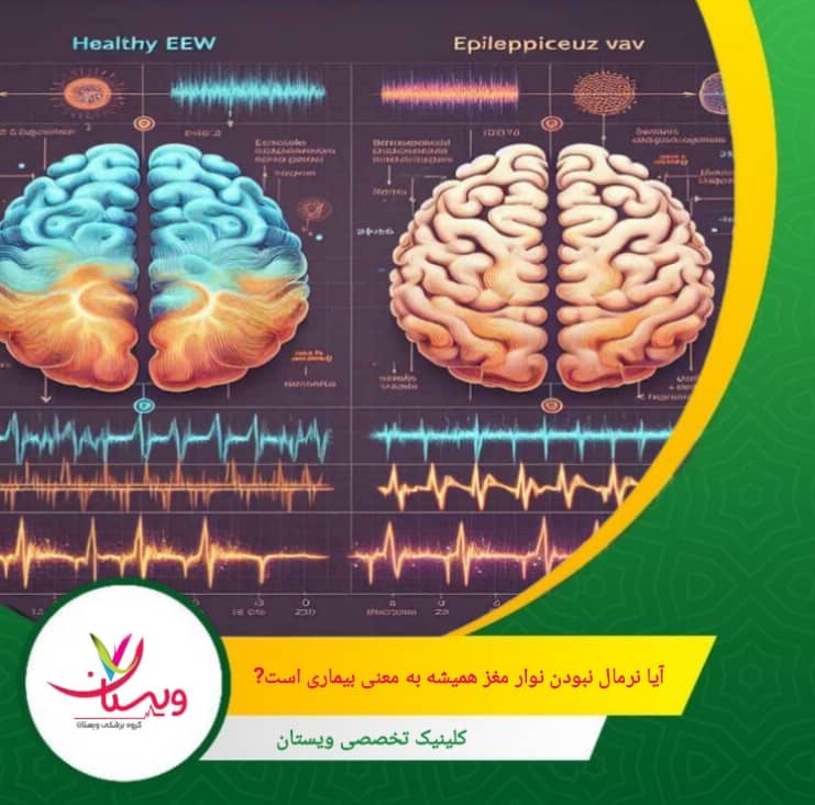 همچنین، برخی شرایط روانپزشکی ممکن است علائمی شبیه بیماریهای مغزی داشته باشند اما در EEG تغییر خاصی دیده نشود. آیا نرمال نبودن نوار مغز همیشه به معنی بیماری است؟