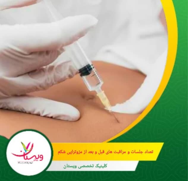 ۲۴ تا ۴۸ ساعت قبل، از کرمها یا محصولات حاوی رتینول و اسیدهای میوه استفاده نکنید تا پوست حساس نشود. تعداد جلسات و مراقبت های قبل و بعد از مزوتراپی شکم