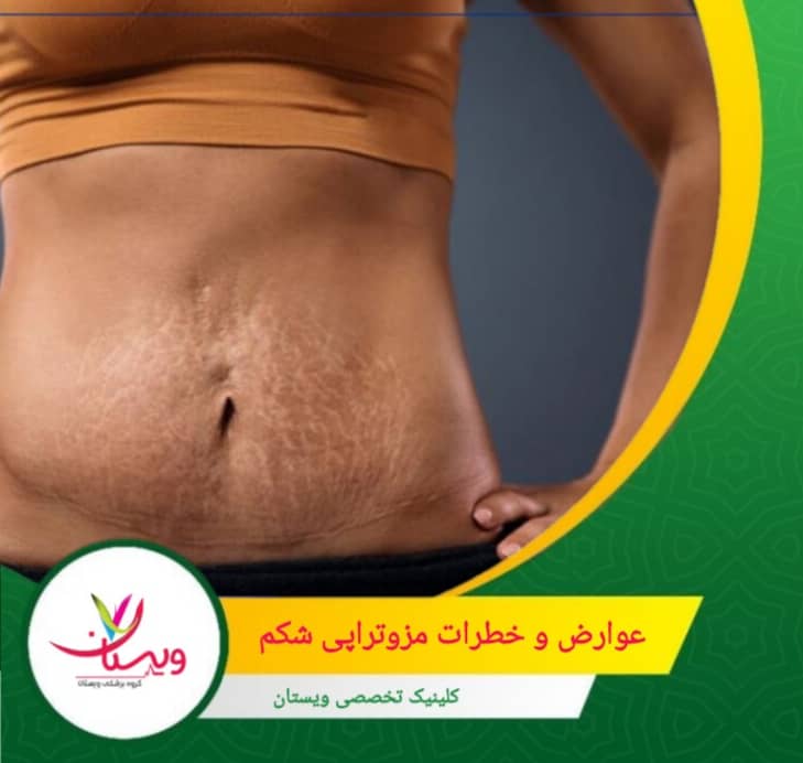 برخی افراد ممکن است پس از تزریق، علائمی مانند تهوع، خستگی یا سرگیجه را تجربه کنند. عوارض و خطرات مزوتراپی شکم