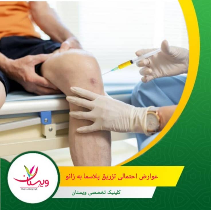 برخی بیماران ممکن است به طور موقت احساس سفتی یا کاهش حرکت در زانو داشته باشند. عوارض احتمالی تزریق پلاسما به زانو چیست؟