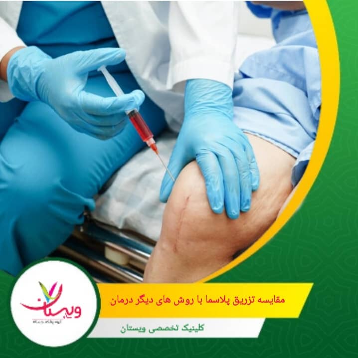فیزیوتراپی برای بهبود عملکرد عضلات و مفصل خوب است. مقایسه تزریق پلاسما با روشهای دیگر درمان
