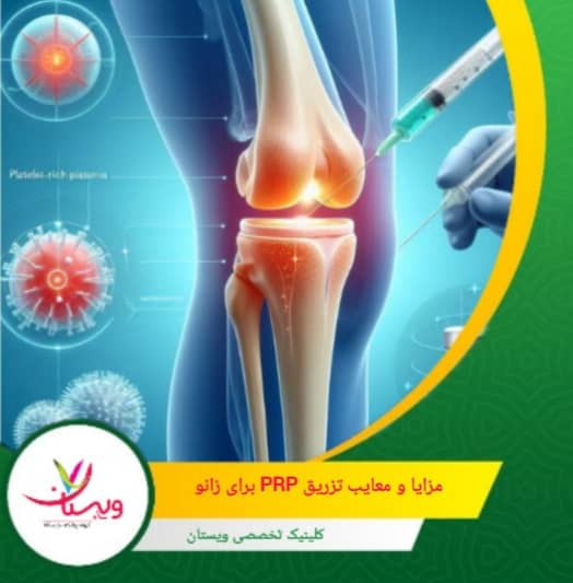 کمتهاجمی و بدون جراحی: مناسب برای کسانی که نمیخواهند یا نمیتوانند جراحی کنند. مزایا و معایب تزریق PRP برای زانو