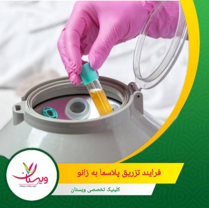 خون در دستگاه سانتریفیوژ قرار میگیرد تا پلاکتها از سایر اجزای خون جدا شوند. فرآیند تزریق پلاسما به زانو