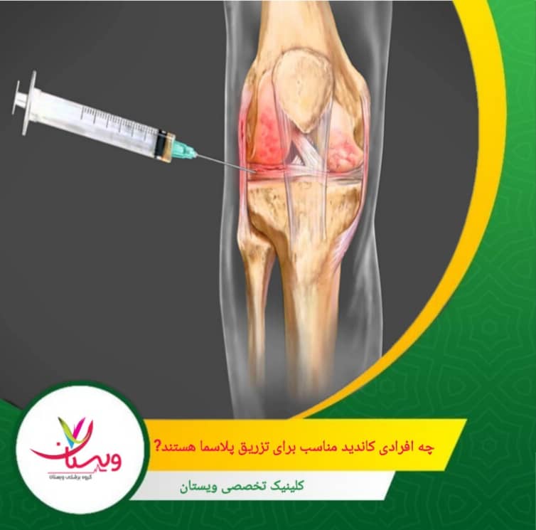 برای بهبود التهاب یا پارگیهای جزئی تاندونها مؤثر است. چه افرادی کاندید مناسب برای تزریق پلاسما هستند؟