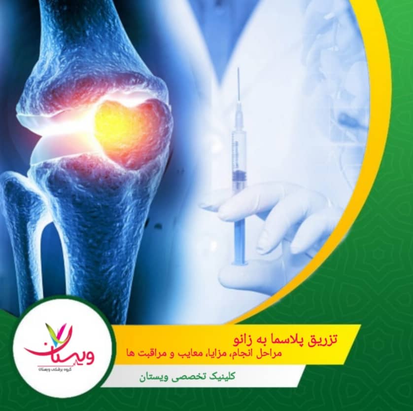 تزریق پلاسما به زانو| مراحل انجام، مزایا، معایب و مراقبتها