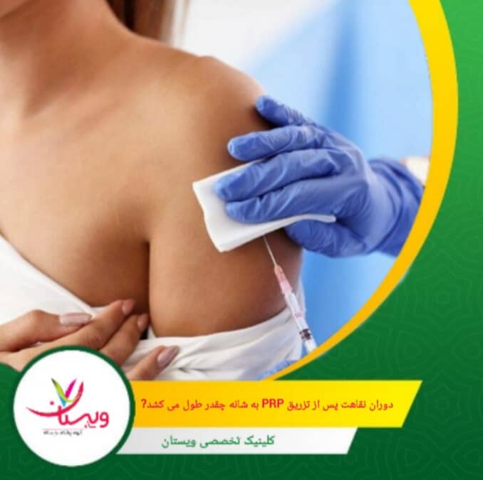 پس از انجام تزریق، بسیاری از بیماران میتوانند فعالیتهای روزمره خود را ظرف چند ساعت تا یک روز از سر بگیرند، اما بهبودی کامل و مشاهده نتایج مثبت ممکن است چند هفته تا چند ماه زمان ببرد. دوران نقاهت پس از تزریق PRP به شانه چقدر طول میکشد؟