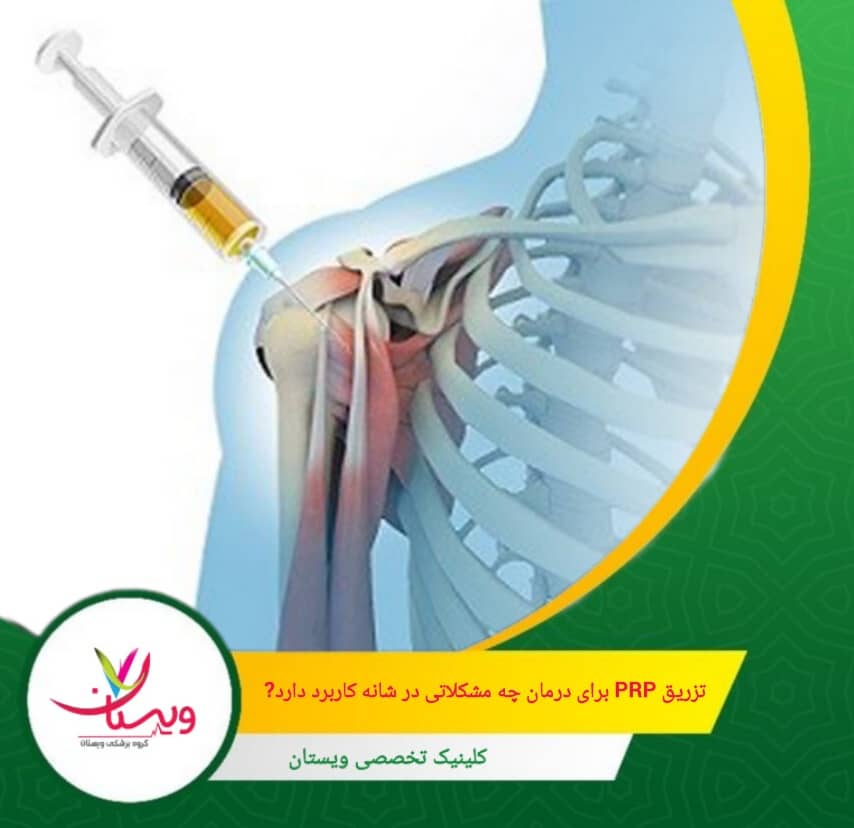 تزریق PRP میتواند در کاهش درد و بهبود عملکرد بیماران مبتلا به پارگیهای جزئی تاندون روتاتور کاف مؤثر باشد. تزریق PRP برای درمان چه مشکلاتی در شانه کاربرد دارد؟