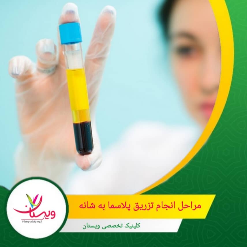 با کمک سونوگرافی، محل دقیق آسیب در شانه شناسایی و PRP به آن ناحیه تزریق میشود. مراحل انجام تزریق پلاسما به شانه