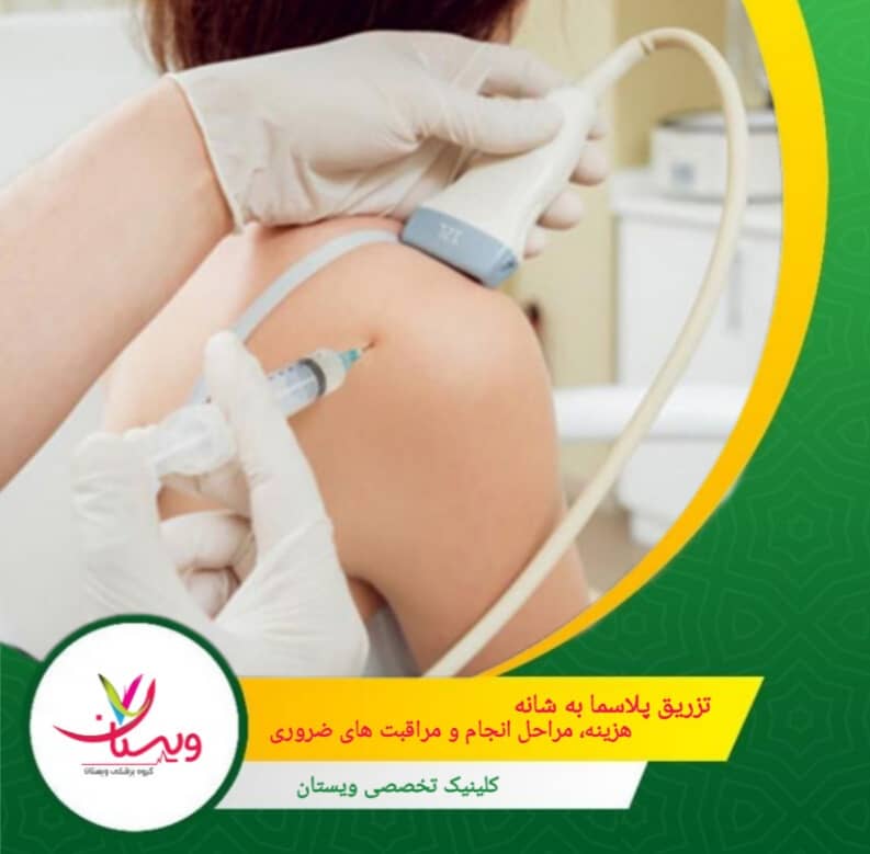 تزریق پلاسما به شانه| هزینه، مراحل انجام، مراقبتهای ضروری