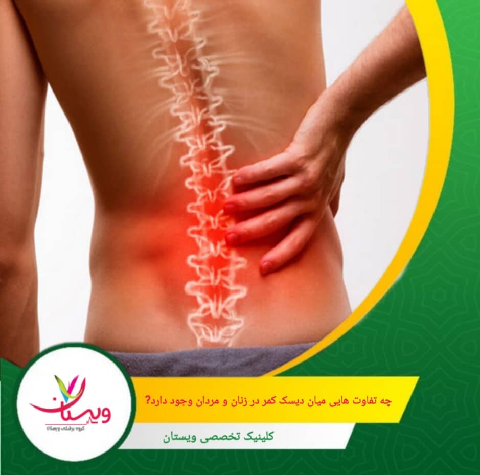 این تفاوتها میتوانند به عوامل مختلفی از جمله تفاوتهای بیولوژیکی، هورمونی و اجتماعی بین زنان و مردان مرتبط باشند. چه تفاوتهایی میان دیسک کمر در زنان و مردان وجود دارد؟