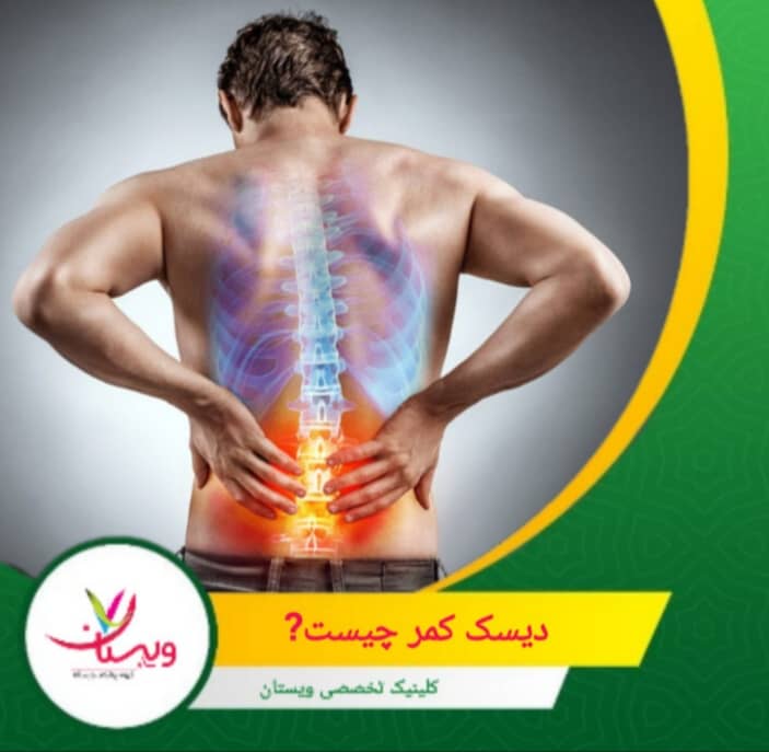 با افزایش سن یا در اثر فشارهای مکرر، ممکن است حلقهی بیرونی دچار پارگی یا ضعف شود و هستهی ژلهای به بیرون نشت کند. این وضعیت را "فتق دیسک" یا "دیسک کمر" مینامند. دیسک کمر چیست؟