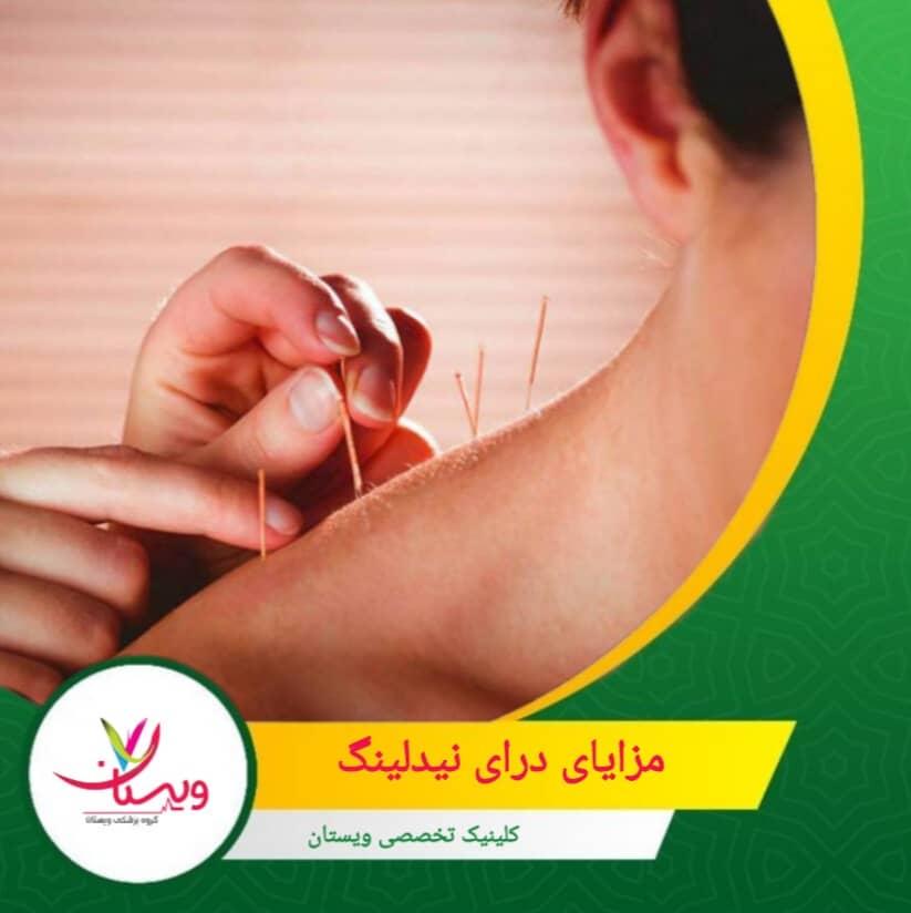 فیزیوتراپیستها از سوزن خشک برای تحریک فرآیند ترمیم طبیعی بدن در عضلات آسیبدیده استفاده میکنند. مزایای درای نیدلینگ از دید بیماران و متخصصان