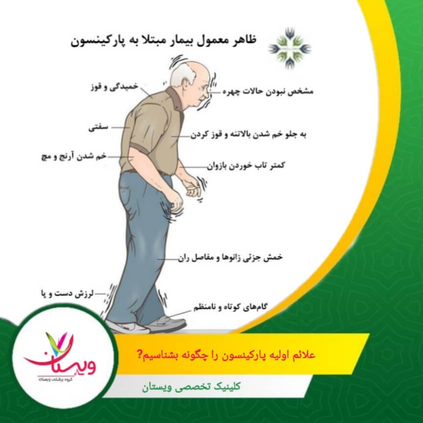 کاهش یا از بین رفتن حالتهای طبیعی چهره، که ممکن است بهصورت چهرهای بیاحساس یا جدی ظاهر شود. علائم اولیه پارکینسون را چگونه بشناسیم؟