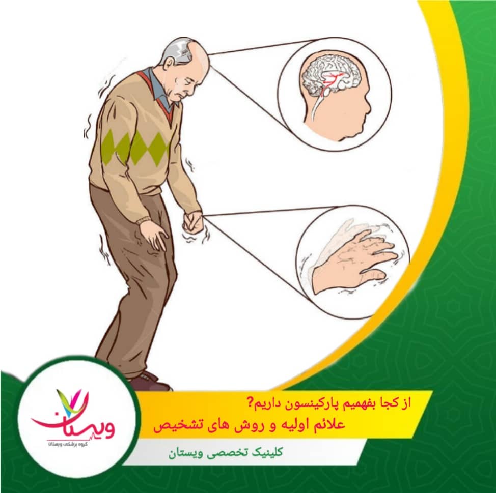 از کجا بفهمیم پارکینسون داریم؟ علائم اولیه و روشهای تشخیص