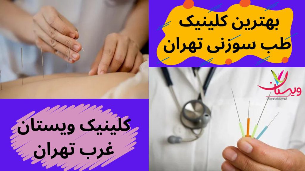 پزشکان طب سوزنی بهترین کلینیک طب سوزنی در تهران