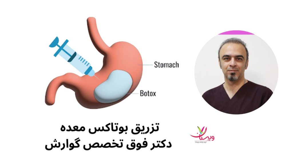 ریفلاکس معده تزریق بوتاکس معده برای چه افرادی مناسب است