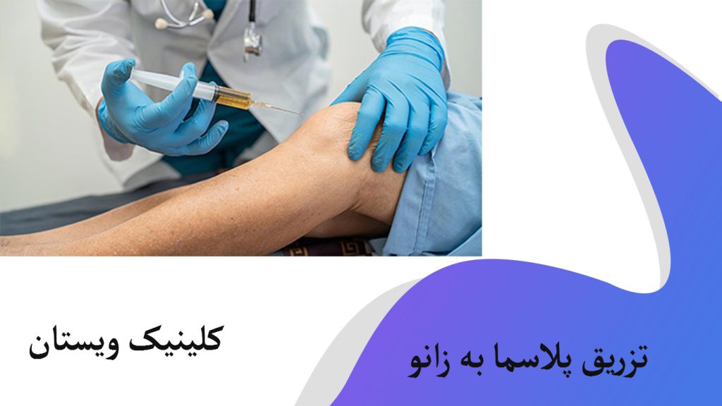 تزریق پلاسما به زانو یک پزشک در حال تزریق پلاسما به زانوی بیمار
