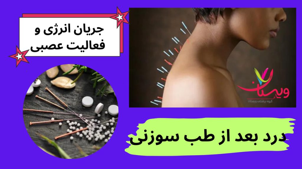علل درد پس از طب سوزنی درد بعد از طب سوزنی