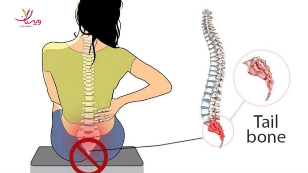 ضد التهابی قوی برای دنبالچه درمان درد دنبالچه با روغن
