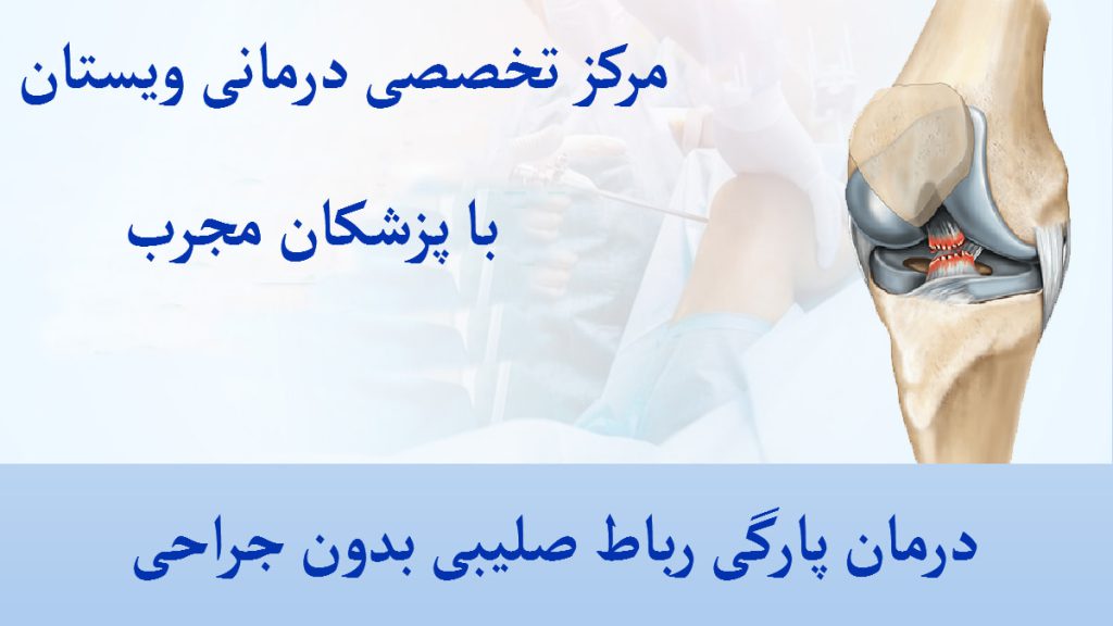 یک مفصل زانو که دچار پارگی رباط صلیبی زانو شده است