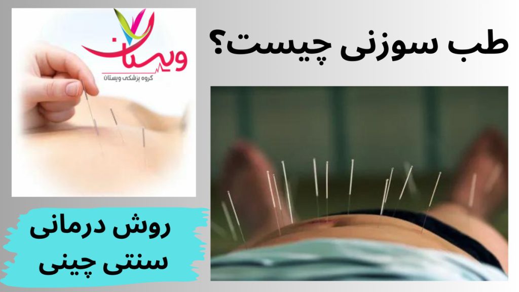 سوزنهای نازک برای تحریک نقاط طب سوزنی چیست
