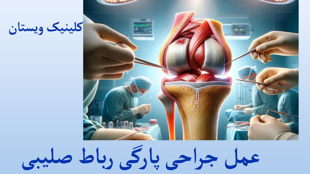 عمل پارگی رباط صلیبی یک تصویر از پزک در حال جراحی رباط صلیبی
