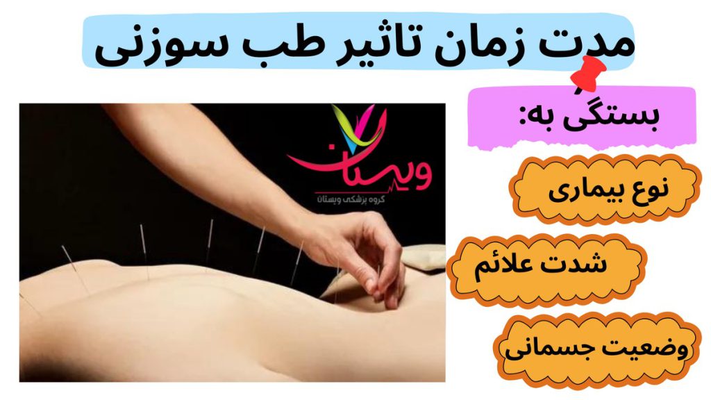 اثرگذاری طب سوزنی مدت زمان تاثیر طب سوزنی