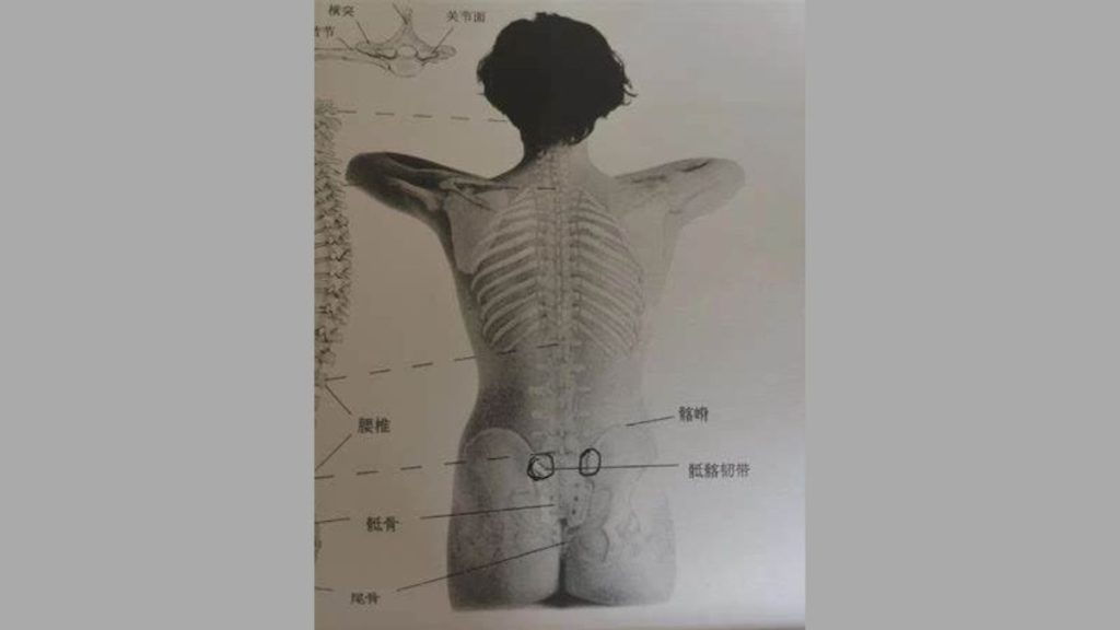 درد دنبالچه مزایای طب سوزنی دنبالچه