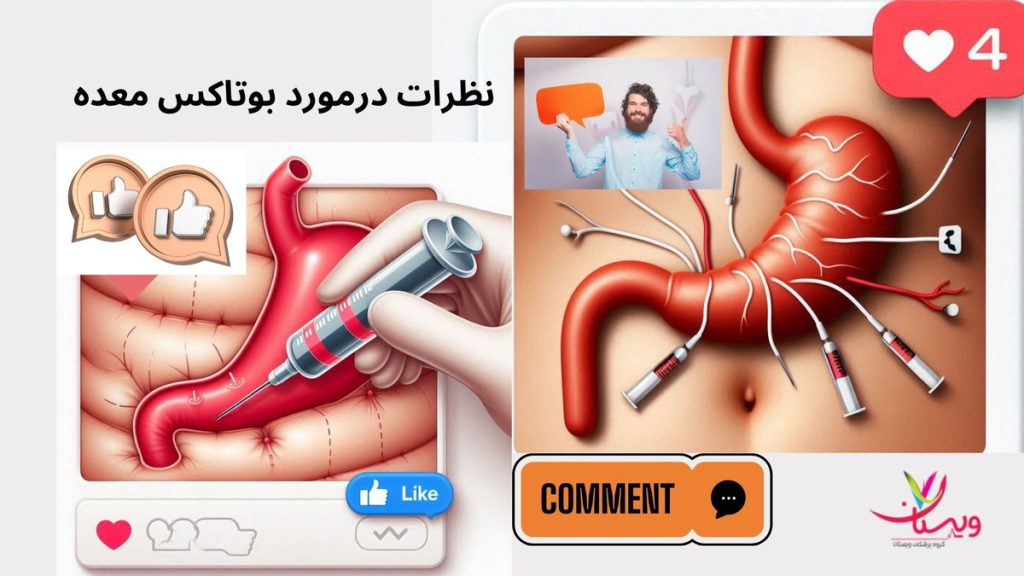 بهترین متخصصان در زمینه بوتاکس معده نظرات در مورد بوتاکس معده درباره بهترین دکتر بوتاکس معده