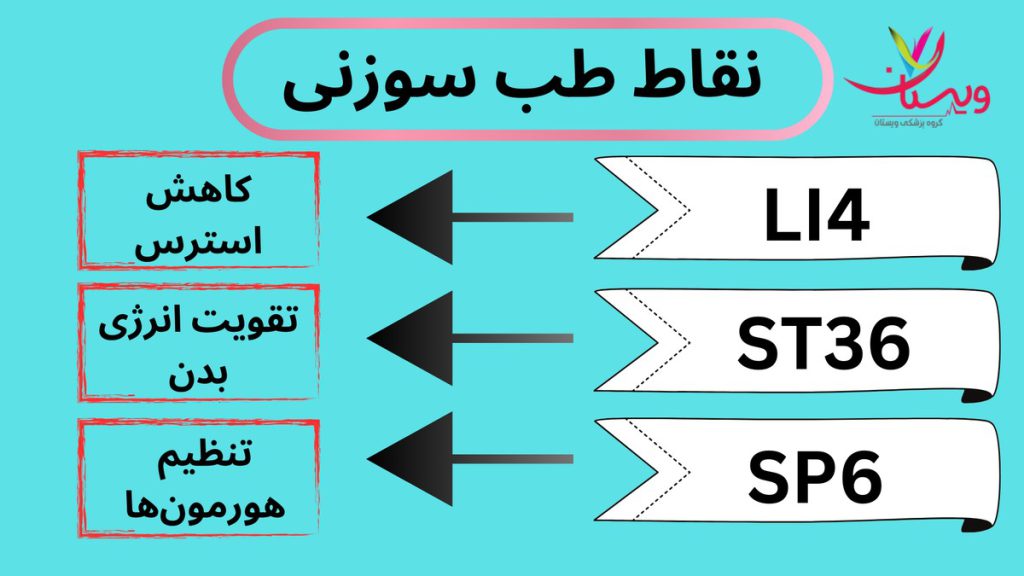 نقاط انرژی نقاط طب سوزنی