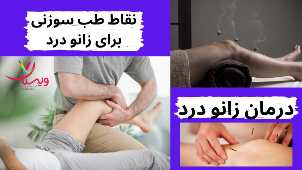 درمان زانو درد نقاط طب سوزنی برای زانو درد