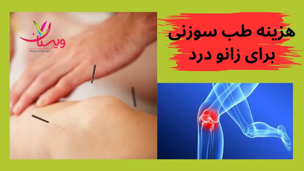 هزینه طب سوزنی برای زانو درد
