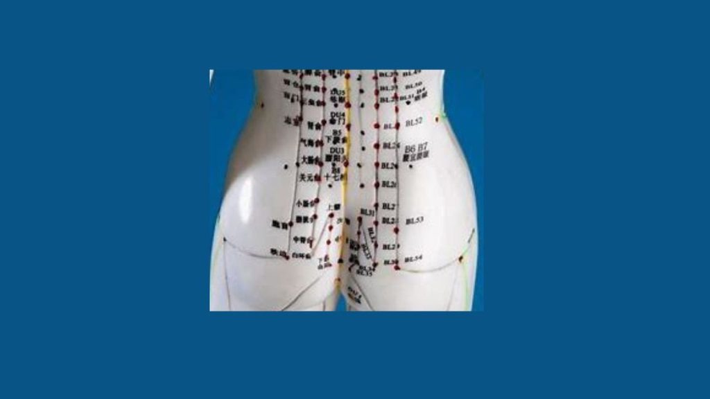 متخصص طب سوزنی هزینه طب سوزنی درد دنبالچه