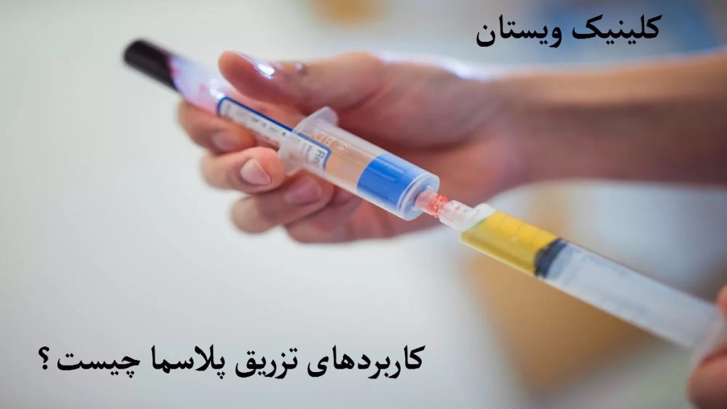 کاربردهای تزریق پلاسما یک شخص در حال تخلیه پپلاسما به داخل سرنگ