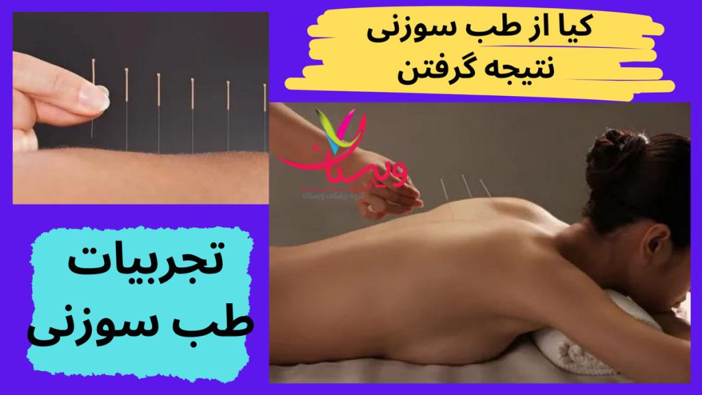 تجربیات طب سوزنی کیا از طب سوزنی نتیجه گرفتن