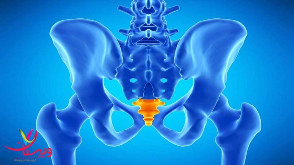 درد دنبالچه درد در قسمت دنبالچه