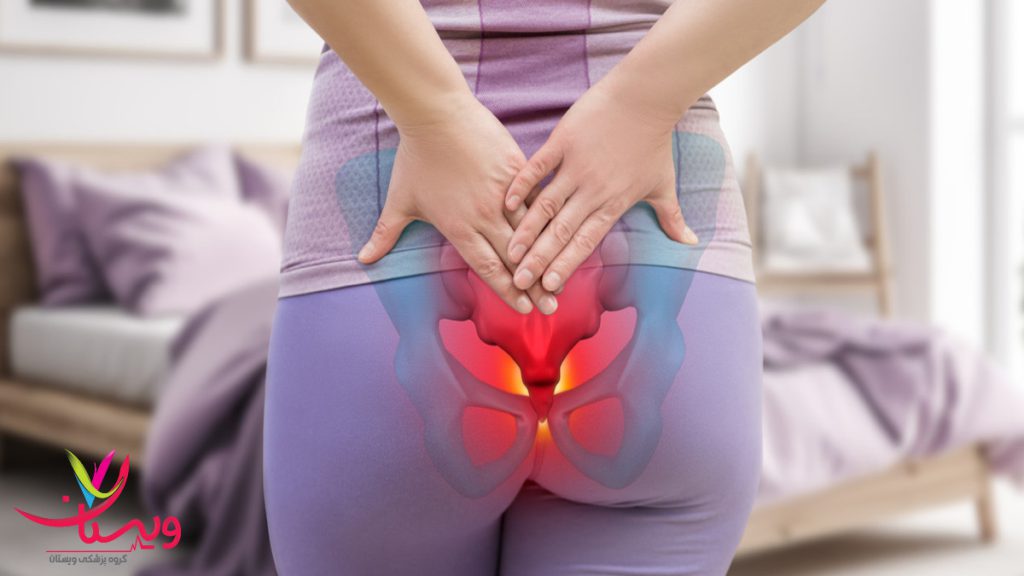 درد دنبالچه در بیمار خانمی که دچار درد دنبالچه شده است