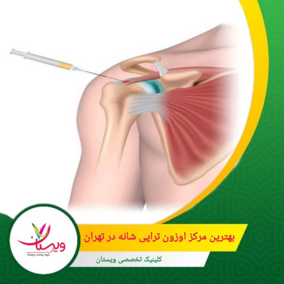 اما انتخاب بهترین کلینیک، تنها به نام و تبلیغات خلاصه نمیشود؛ بلکه باید به تجربه پزشکان، کیفیت تجهیزات، رضایت بیماران و شفافیت در قیمتگذاری توجه کرد. بهترین مرکز اوزونتراپی شانه در تهران
