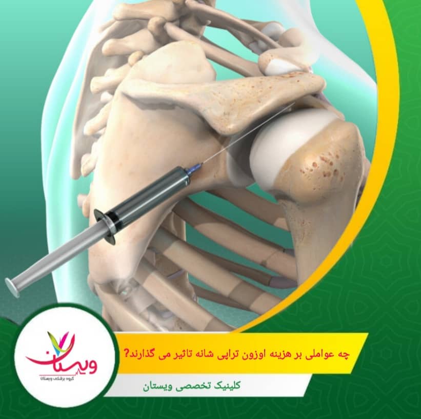 استفاده از تجهیزات استریل، گاز خالص و برندهای معتبر، میتواند هزینه را افزایش دهد ولی به ایمنی و اثربخشی درمان میافزاید. چه عواملی بر هزینه اوزون تراپی شانه تأثیر میگذارند؟