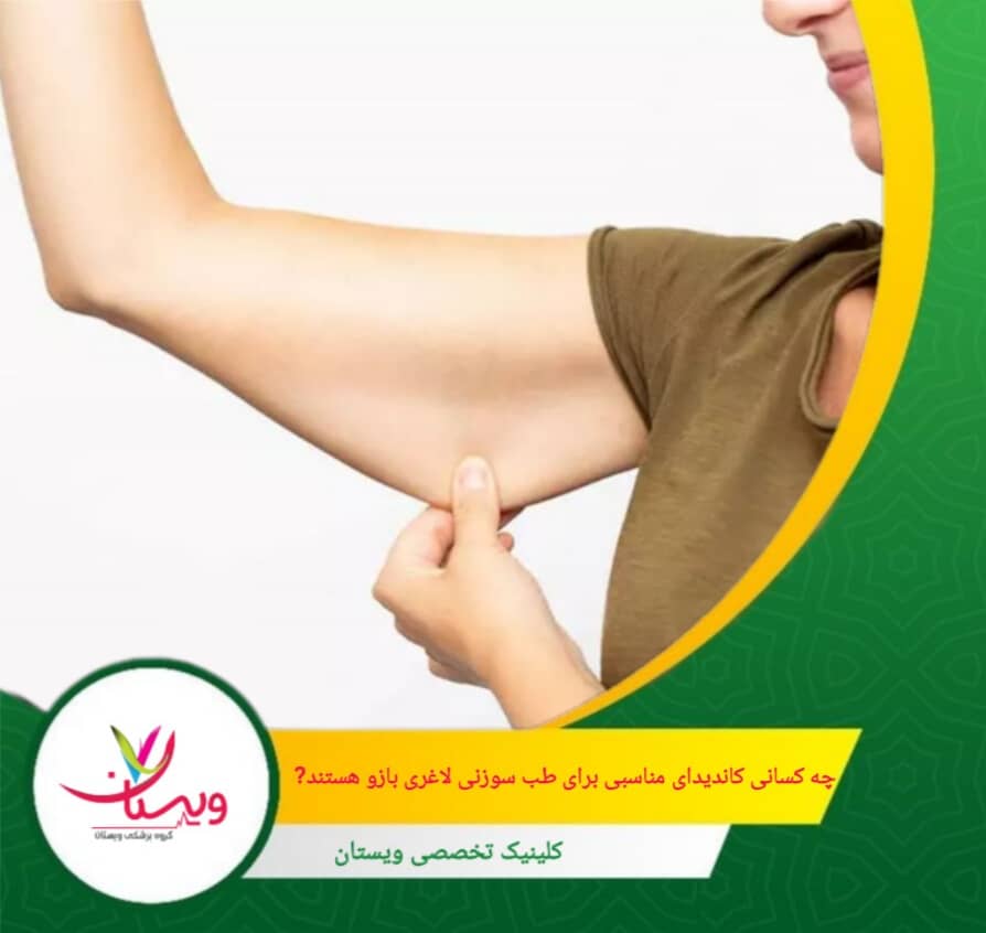 کسانی که میخواهند بدون دارو و جراحی، روند کاهش وزن را تسهیل کنند، طب سوزنی گزینهای کمخطر و مؤثر است. چه کسانی کاندیدای مناسبی برای طب سوزنی لاغری بازو هستند؟