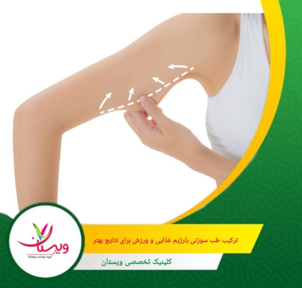طب سوزنی میتواند با تنظیم هورمونهایی مانند لپتین و گرلین، به کاهش اشتها و افزایش متابولیسم کمک کند. ترکیب طب سوزنی با رژیم غذایی و ورزش برای نتایج بهتر